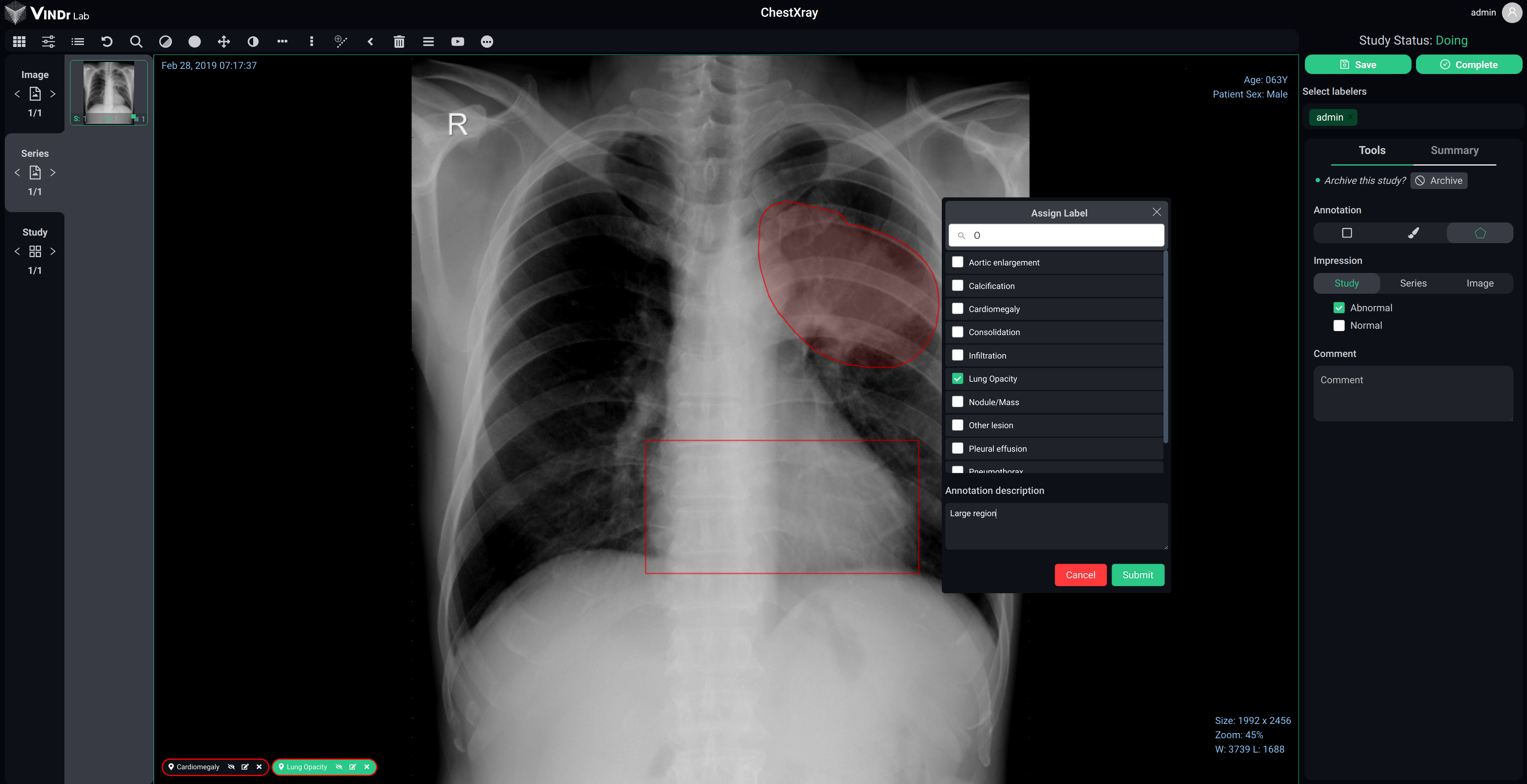 VinDr Lab screenshot